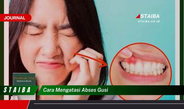 Ketahui Cara Mengatasi Abses Gusi dengan Cepat dan Aman di Rumah
