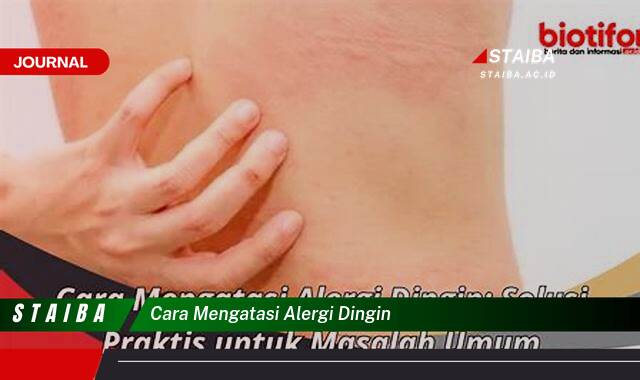 Ketahui Cara Mengatasi Alergi Dingin Secara Efektif dan Alami Ketahui Cara Mengatasi Alergi Dingin Secara Efektif dan Alami