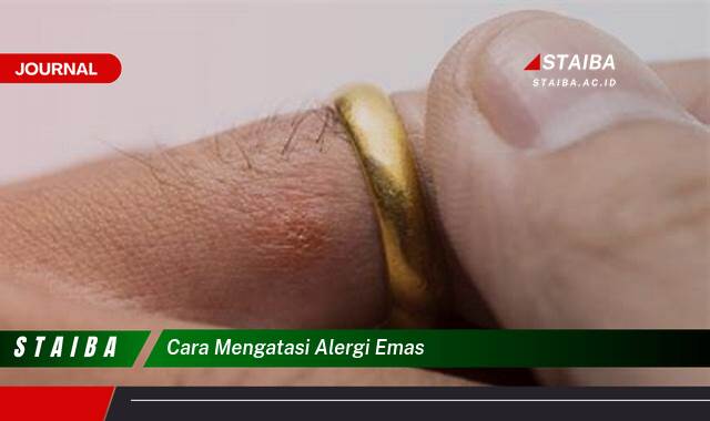 Ketahui Cara Mengatasi Alergi Emas, Tips dan Trik Ampuh Ketahui Cara Mengatasi Alergi Emas, Tips dan Trik Ampuh