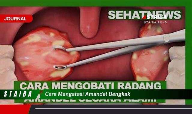 Ketahui Cara Mengatasi Amandel Bengkak Dengan Cepat dan Alami