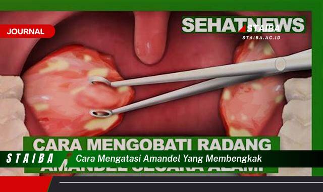 Ketahui Cara Mengatasi Amandel yang Membengkak dengan Cepat dan Alami