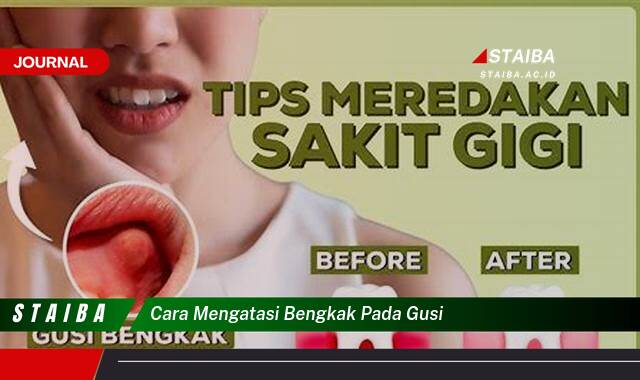 Ketahui Cara Mengatasi Bengkak Pada Gusi dengan Cepat dan Alami