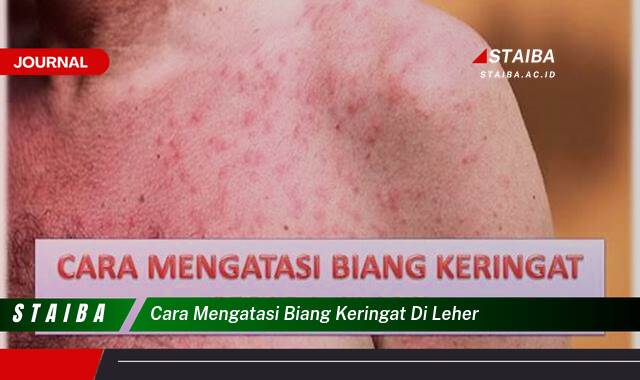 Ketahui Cara Mengatasi Biang Keringat di Leher dengan Cepat dan Alami Ketahui Cara Mengatasi Biang Keringat di Leher dengan Cepat dan Alami