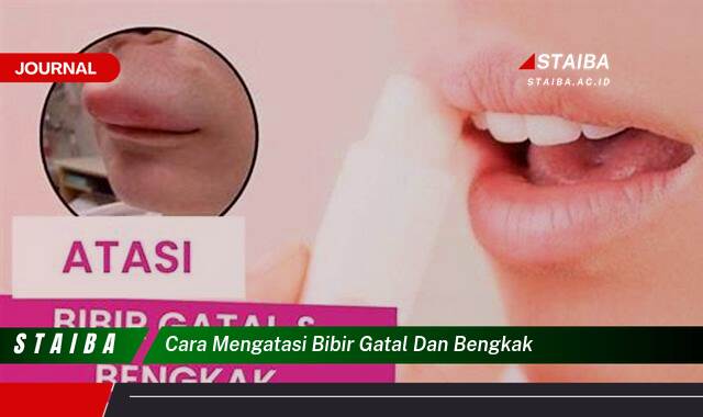 Ketahui Cara Mengatasi Bibir Gatal dan Bengkak Secara Efektif