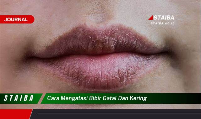 Ketahui Cara Mengatasi Bibir Gatal dan Kering Secara Alami dan Efektif Ketahui Cara Mengatasi Bibir Gatal dan Kering Secara Alami dan Efektif