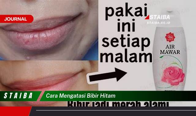 Ketahui Cara Mengatasi Bibir Hitam Secara Alami dan Cepat
