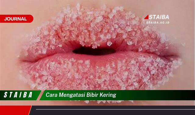 Ketahui Cara Mengatasi Bibir Kering dan Pecah,pecah Secara Alami