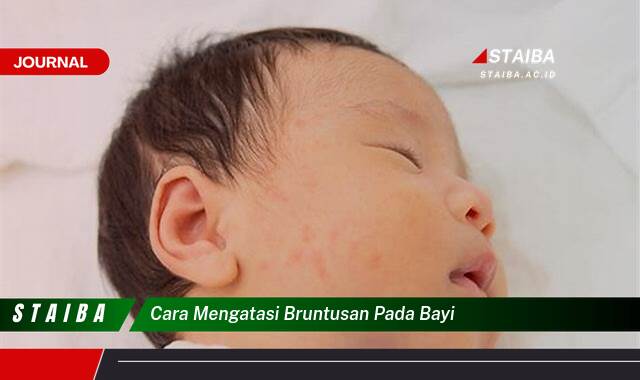 Ketahui Cara Mengatasi Bruntusan Pada Bayi Secara Alami dan Efektif Ketahui Cara Mengatasi Bruntusan Pada Bayi Secara Alami dan Efektif