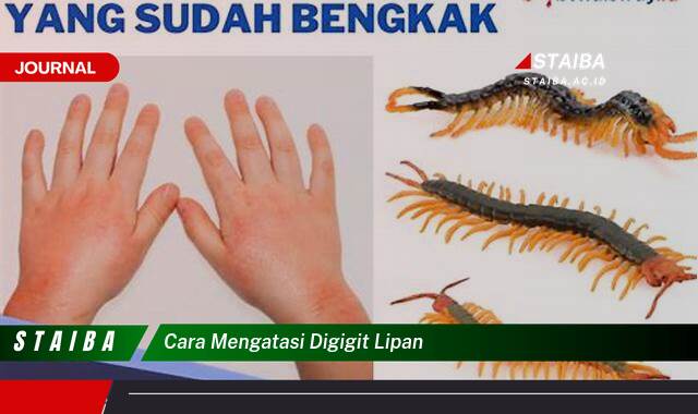 Ketahui Cara Mengatasi Digigit Lipan, Pertolongan Pertama dan Obat Alami untuk Meredakan Nyeri dengan Cepat Ketahui Cara Mengatasi Digigit Lipan, Pertolongan Pertama dan Obat Alami untuk Meredakan Nyeri dengan Cepat