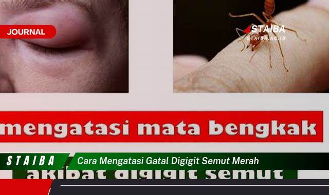 Ketahui Cara Mengatasi Gatal Digigit Semut Merah dengan Cepat dan Ampuh Ketahui Cara Mengatasi Gatal Digigit Semut Merah dengan Cepat dan Ampuh