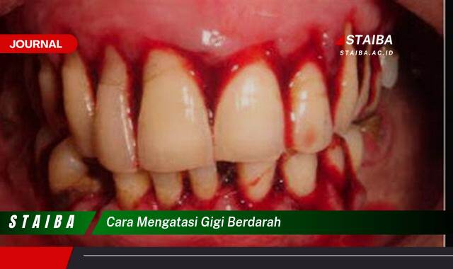 Ketahui Cara Mengatasi Gigi Berdarah dengan Cepat dan Efektif