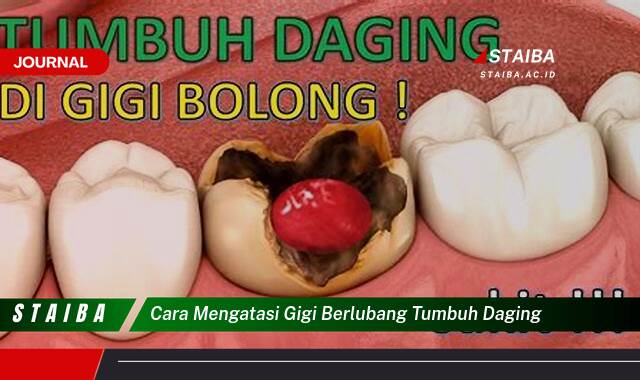 Ketahui Cara Mengatasi Gigi Berlubang yang Tumbuh Daging Secara Efektif dan Aman