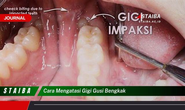 Ketahui Cara Mengatasi Gigi Gusi Bengkak Secara Efektif dan Alami