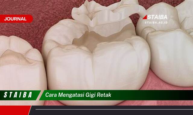 Ketahui Cara Mengatasi Gigi Retak, Solusi Efektif dan Perawatan di Rumah