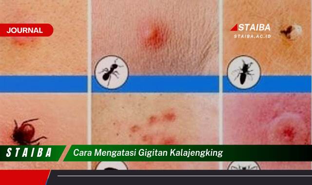 Ketahui Cara Mengatasi Gigitan Kalajengking dengan Cepat dan Tepat Ketahui Cara Mengatasi Gigitan Kalajengking dengan Cepat dan Tepat