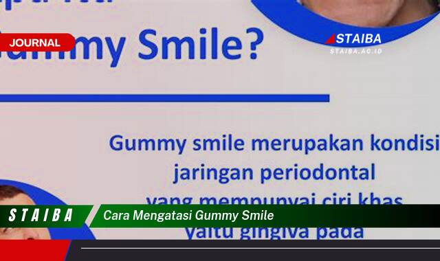 Temukan Cara Mengatasi Gummy Smile Secara Efektif dan Alami