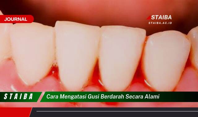 Ketahui Cara Mengatasi Gusi Berdarah Secara Alami dengan Cepat dan Ampuh