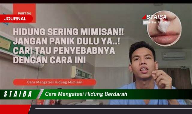 Ketahui Cara Mengatasi Hidung Berdarah dengan Cepat dan Efektif
