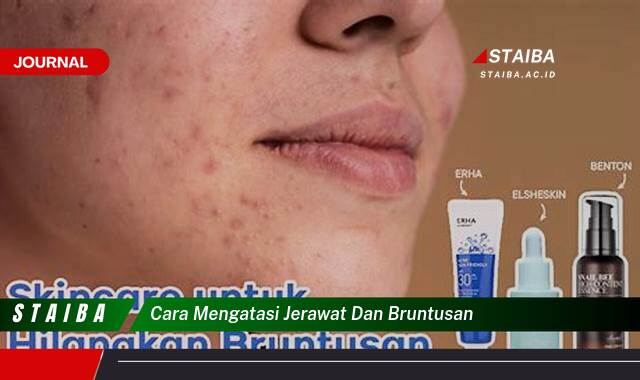 Ketahui Cara Mengatasi Jerawat dan Bruntusan Secara Alami dan Efektif
