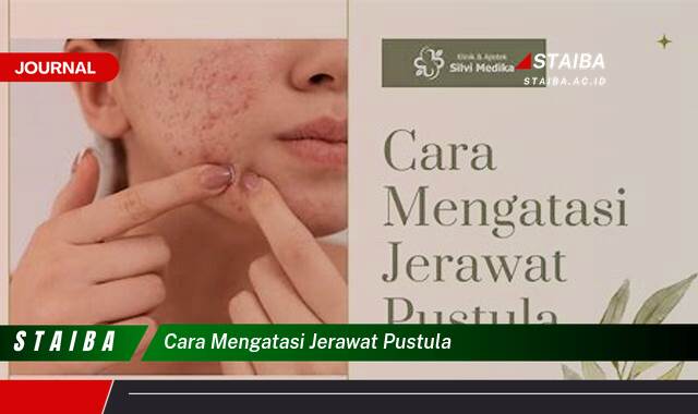 Ketahui Cara Mengatasi Jerawat Pustula dengan Cepat dan Ampuh