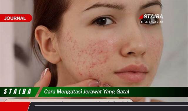 Ketahui Cara Mengatasi Jerawat yang Gatal dengan Cepat dan Ampuh