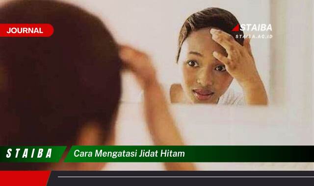 Temukan Cara Mengatasi Jidat Hitam Secara Efektif dan Alami
