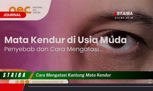 Ketahui Cara Mengatasi Kantung Mata Kendur Secara Efektif dan Alami Ketahui Cara Mengatasi Kantung Mata Kendur Secara Efektif dan Alami