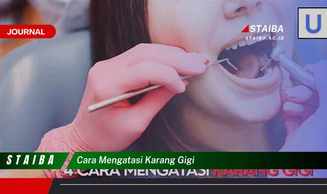 Ketahui Cara Mengatasi Karang Gigi Secara Alami dan Mencegahnya Kembali