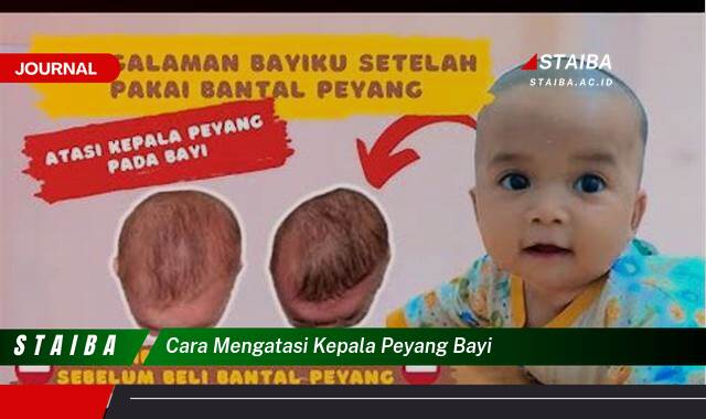 Ketahui Cara Mengatasi Kepala Peyang pada Bayi, Tips Ampuh dan Pencegahan