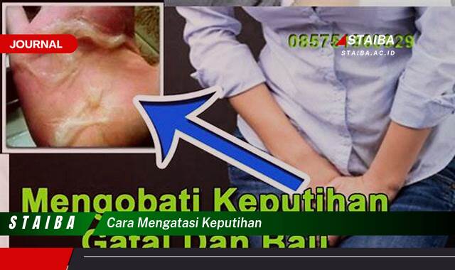 Ketahui Cara Mengatasi Keputihan Secara Alami dan Efektif