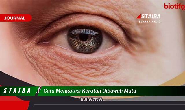 Temukan Cara Mengatasi Kerutan di Bawah Mata Secara Alami dan Efektif Temukan Cara Mengatasi Kerutan di Bawah Mata Secara Alami dan Efektif