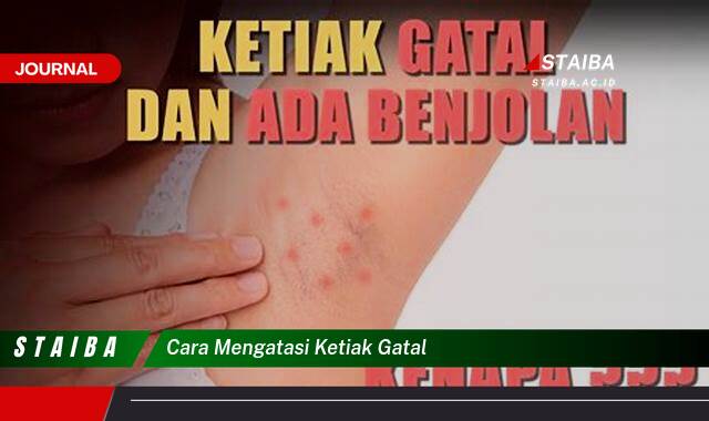 Ketahui Cara Mengatasi Ketiak Gatal dengan Cepat dan Ampuh Ketahui Cara Mengatasi Ketiak Gatal dengan Cepat dan Ampuh