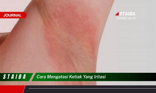 Ketahui Cara Mengatasi Ketiak yang Iritasi dengan Cepat dan Alami