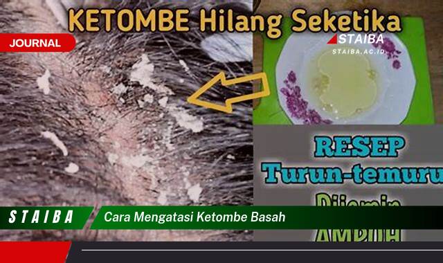 Ketahui Cara Mengatasi Ketombe Basah dengan Cepat dan Ampuh