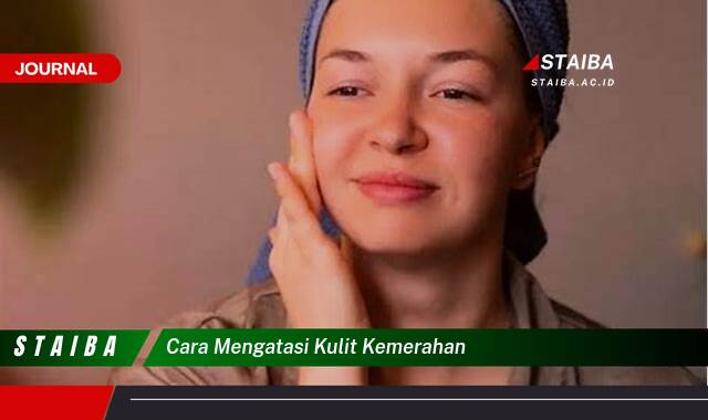Ketahui Cara Mengatasi Kulit Kemerahan Secara Alami dan Efektif