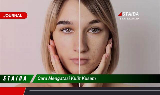 Ketahui Cara Mengatasi Kulit Kusam Secara Alami dan Cepat
