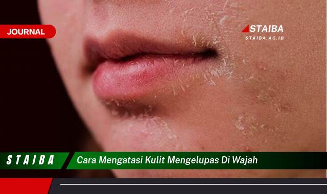 Temukan Cara Mengatasi Kulit Mengelupas di Wajah Secara Efektif dan Alami Temukan Cara Mengatasi Kulit Mengelupas di Wajah Secara Efektif dan Alami