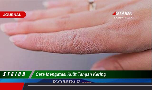 Ketahui Cara Mengatasi Kulit Tangan Kering dan Kasar Secara Alami