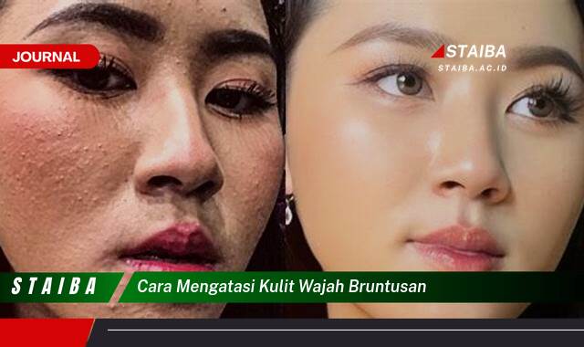 Ketahui Cara Mengatasi Kulit Wajah Bruntusan Secara Alami dan Efektif Ketahui Cara Mengatasi Kulit Wajah Bruntusan Secara Alami dan Efektif