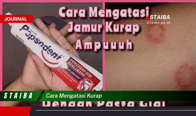 Ketahui Cara Mengatasi Kurap dengan Cepat dan Efektif