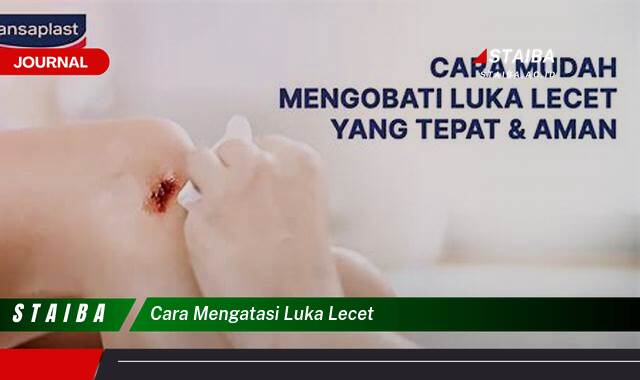 Ketahui Cara Mengatasi Luka Lecet dengan Cepat dan Efektif
