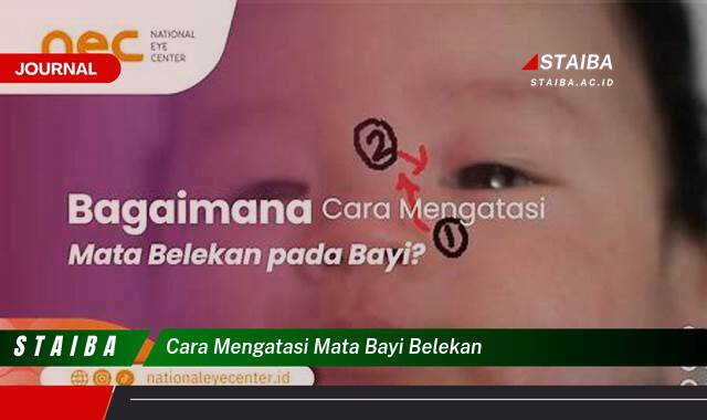 Ketahui Cara Mengatasi Mata Bayi Belekan Secara Efektif dan Aman Ketahui Cara Mengatasi Mata Bayi Belekan Secara Efektif dan Aman