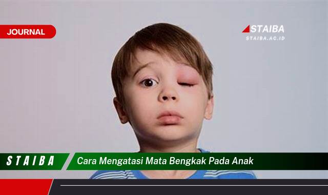 Ketahui Cara Mengatasi Mata Bengkak pada Anak, Penyebab dan Solusinya
