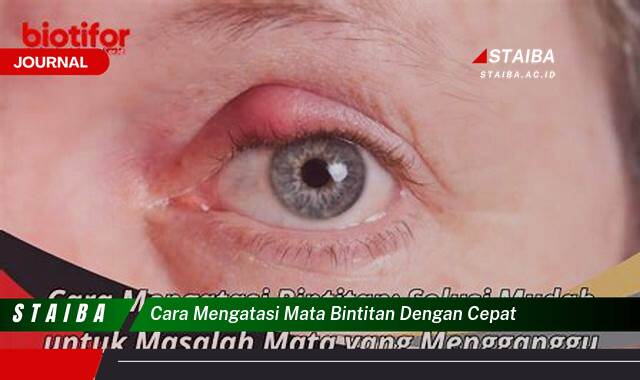 Ketahui Cara Mengatasi Mata Bintitan dengan Cepat dan Aman di Rumah