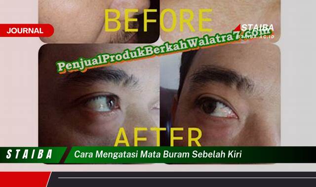 Ketahui Cara Mengatasi Mata Buram Sebelah Kiri, Penyebab dan Solusinya