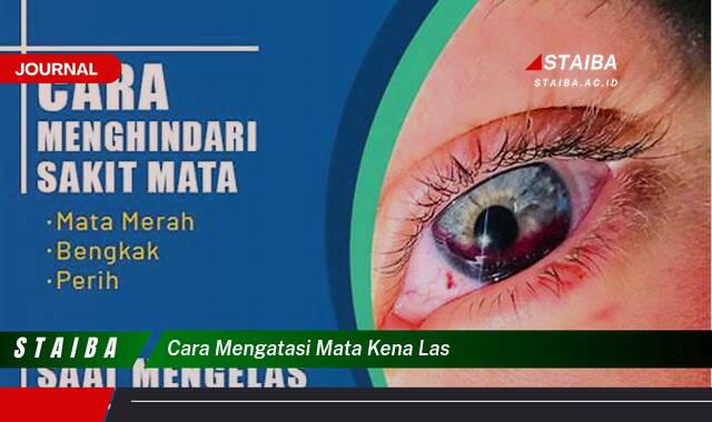 Ketahui Cara Mengatasi Mata Kena Las dengan Cepat dan Aman Ketahui Cara Mengatasi Mata Kena Las dengan Cepat dan Aman