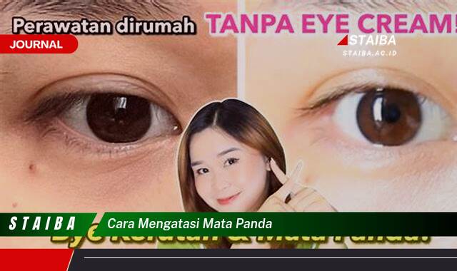 Ketahui Cara Mengatasi Mata Panda dengan Cepat dan Mudah