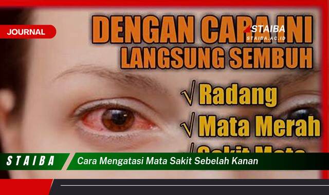 Ketahui Cara Mengatasi Mata Sakit Sebelah Kanan Secara Efektif dan Alami Ketahui Cara Mengatasi Mata Sakit Sebelah Kanan Secara Efektif dan Alami