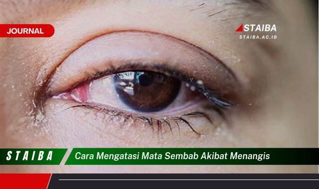 Ketahui Cara Mengatasi Mata Sembab Akibat Menangis dengan Cepat dan Alami