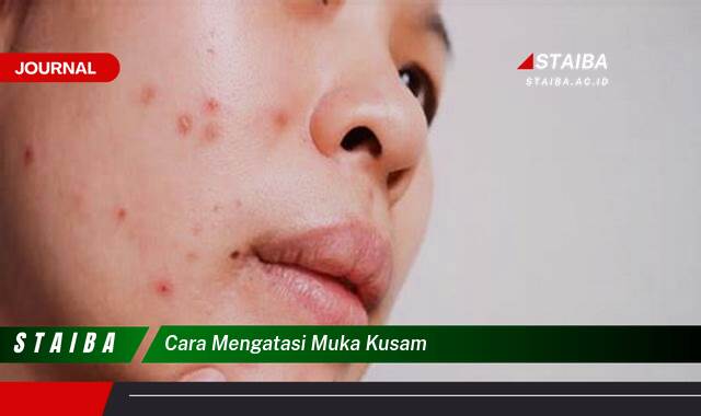 Ketahui Cara Mengatasi Muka Kusam dan Mendapatkan Kulit Cerah Berseri Ketahui Cara Mengatasi Muka Kusam dan Mendapatkan Kulit Cerah Berseri